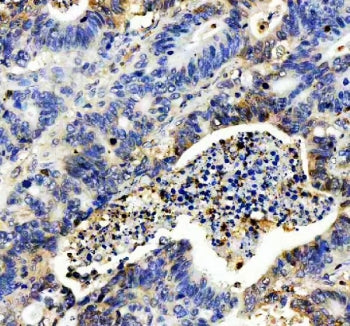 IL-8 Antibody
