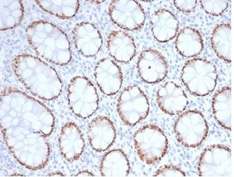 SATB2 Antibody