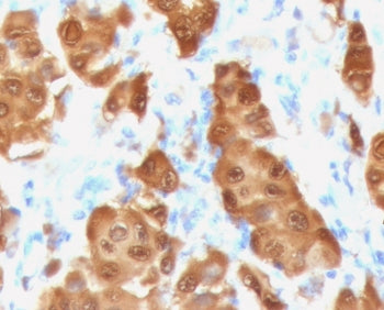 S100B Antibody
