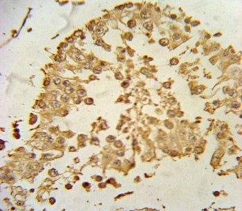 ZDHHC21 Antibody / DHHC-21