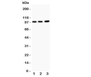 EPB41L1 Antibody