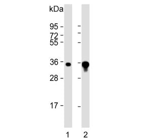 AKR1B1 Antibody / Aldose reductase