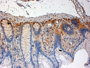 CSK Antibody