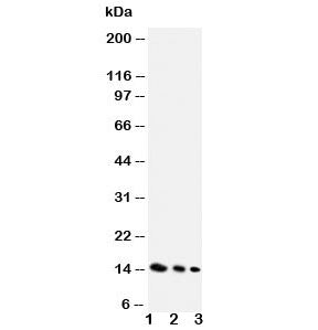 Western blot testing of IL-4 antibody and Lane 1: recombinant mouse protein 10ng; 2: 5ng; 3: 2.5ng.