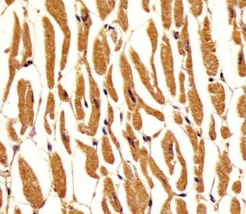 PGM1 Antibody / Phosphoglucomutase 1