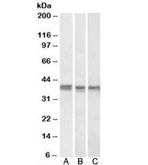 POLDIP2 Antibody