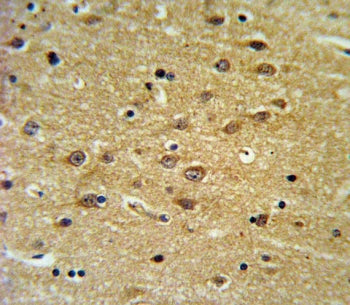 EHD3 Antibody