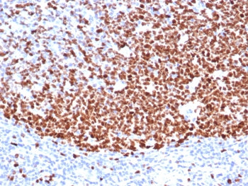 IHC staining of FFPE human tonsil tissue with Ki67 antibody (clone MKI67/6571). HIER: boil tissue se