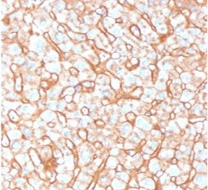 APOB Antibody / Apolipoprotein B