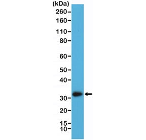 Recombinant Calretinin Antibody / Calbindin 2 / CALB2
