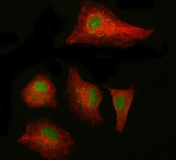 NAB1 Antibody / NGFI-A-binding protein 1