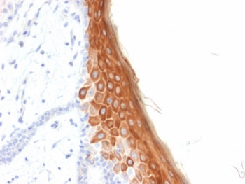 KRT10 Antibody / Cytokeratin 10
