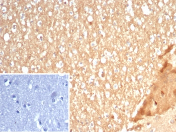 S100A5 Antibody