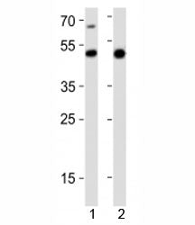 Western blot analysis of lysate from 1) mouse heart and 2) rat stomach tissue lysate using Gata6 ant