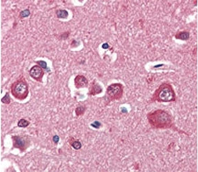PINK1 Antibody