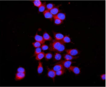 Immunofluorescent staining of FFPE human MCF7 cells with RAB7 antibody (red) and DAPI nuclear stain