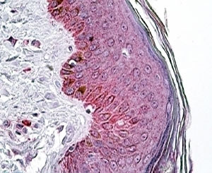 PNPLA3 Antibody