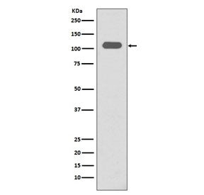 Integrin beta 3 Antibody / ITGB3 / CD61