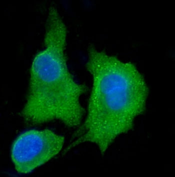 Immunofluorescent staining of FFPE human A549 cells with Aldehyde dehydrogenase 3 antibody (green) and DAPI nuclear stain (blue). HIER: steam section in pH6 citrate buffer for 20 min.