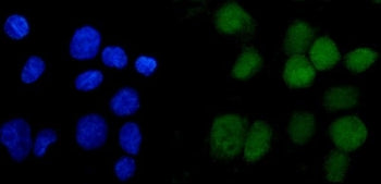 Immunofluorescent staining of FFPE human A431 cells with ANAPC2 antibody (green) and DAPI nuclear st