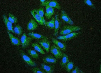 Immunofluorescent staining of FFPE human U-2 OS cells with Hsp27 antibody (green) and DAPI (blue). H