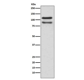 p120 Catenin Antibody / CTNND1 / Catenin delta 1