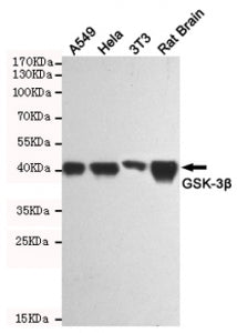 GSK3 beta Antibody / GSK3B