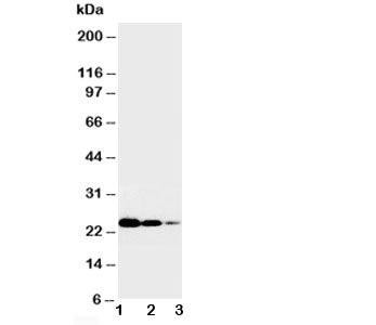 Western blot testing of TNFR1 antibody and Lane 1: Recombinant human TNFR1 protein 10ng; 2: 5ng; 3: