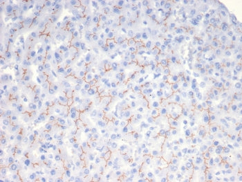 BSEP Antibody / Bile Salt Export Pump / ABCB11