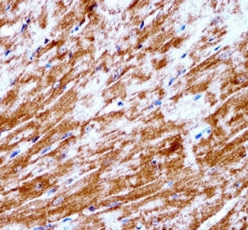 PDK2 Antibody / Pyruvate dehydrogenase kinase 2