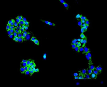 MC4R Antibody / MC4-R / Melanocortin Receptor 4
