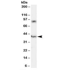 HCST Antibody