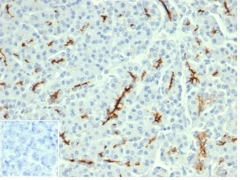 IHC staining of FFPE human pancreatic tissue with recombinant CFTR antibody (clone CFTR/6477R). Nega