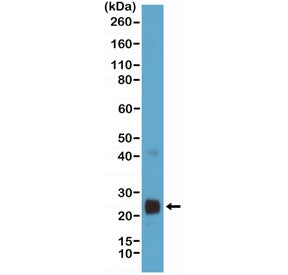 Recombinant VEGFA Antibody