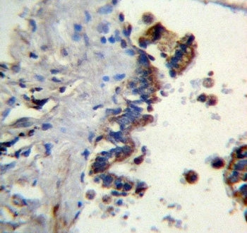 Ficolin 3 Antibody / FCN3