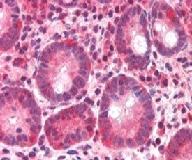 BAZ2B Antibody