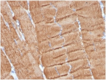 IHC staining of FFPE human skeletal muscle with Actin alpha 1 antibody (clone ACTA1/360). HIER: boil