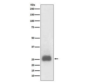 TIMP1 Antibody