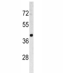 TROP2 Antibody