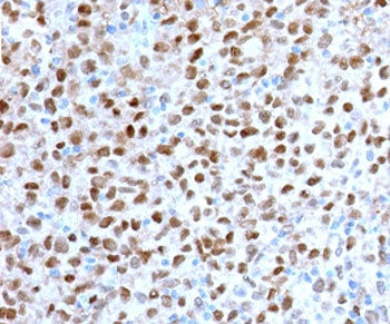 MITF Antibody