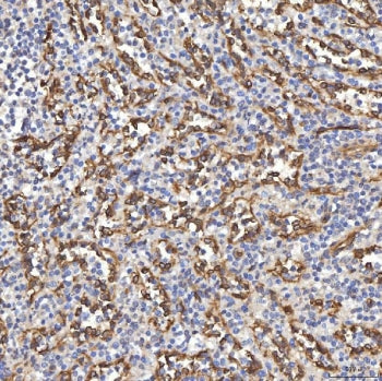 TP53I13 Antibody / Tumor protein p53-inducible protein 13