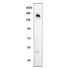 CD163 Antibody