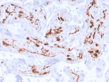 IHC staining of FFPE human placenta with recombinant F13A1 antibody (clone F13A1/3772R). HIER: boil