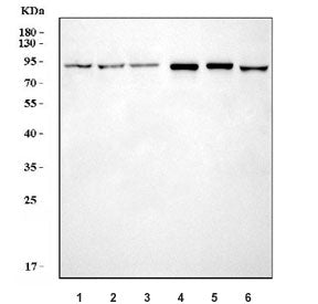 Western blot testing of 1) human HeLa, 2) human 293T, 3) human A549, 4) rat kidney, 5) mouse kidney
