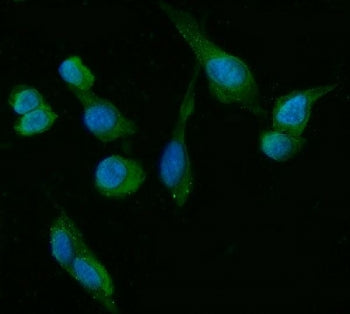 HSD3B1/2 Antibody