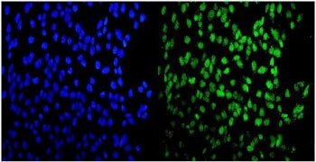 Immunofluorescent staining of FFPE human U-2 OS cells with MEF2A antibody (green) and DAPI nuclear s