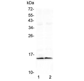 FABP3 Antibody (cardiac)