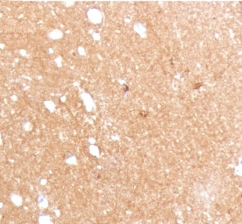 IHC staining of FFPE human brain with Beta Tubulin antibody (clone TBBT3-1). HIER: boil tissue secti