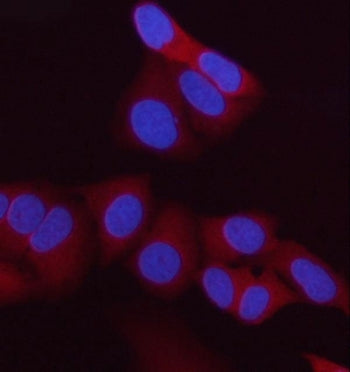 Immunofluorescent staining of FFPE human HeLa cells with HIP antibody (red) and DAPI nuclear stain (