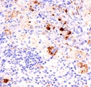 TNF alpha Antibody Cocktail